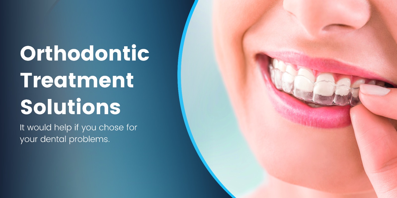 Orthodontic Treatment Solutions